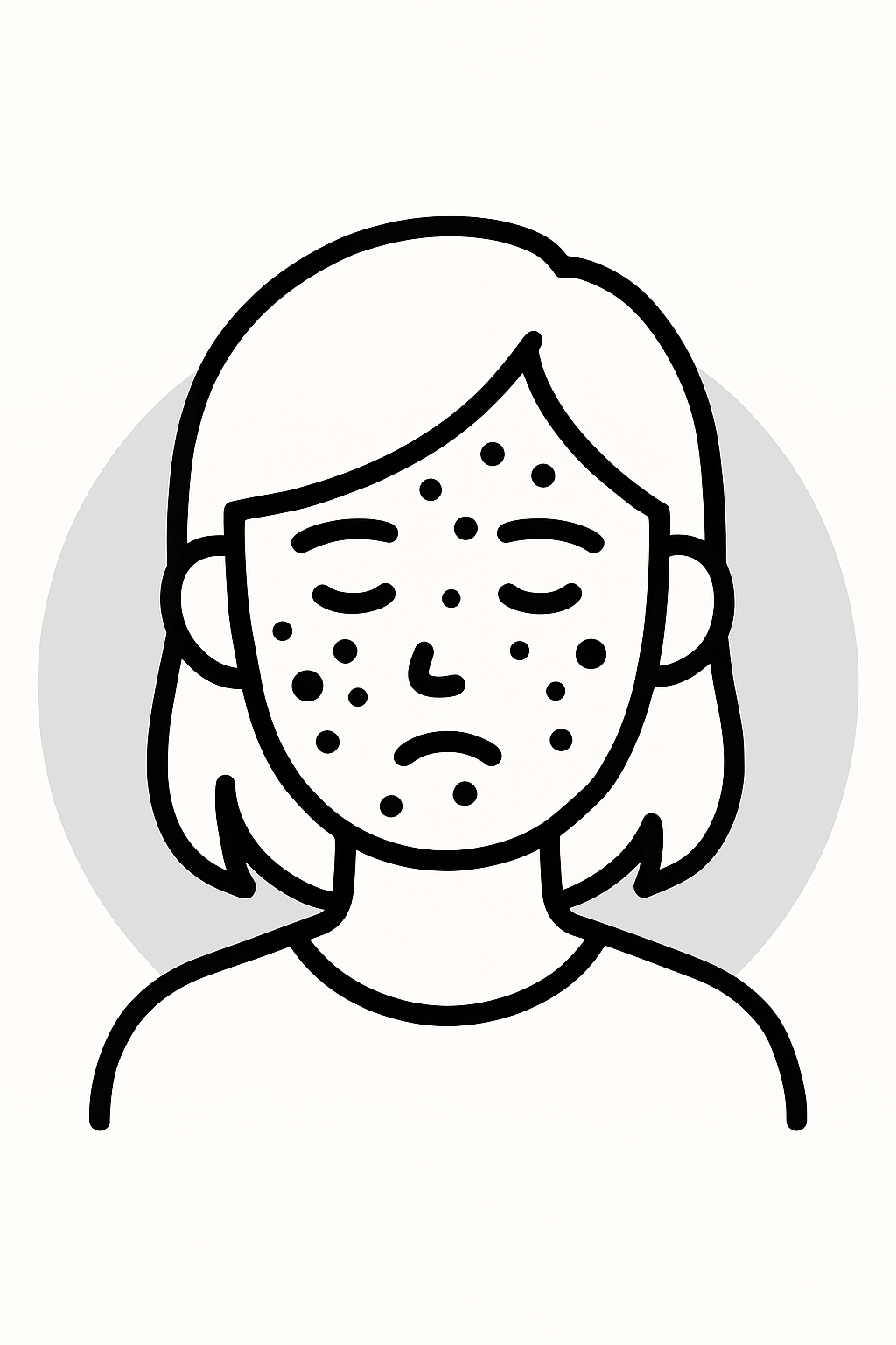 Acne Treatment
