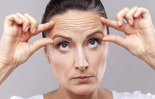 Forehead Lines